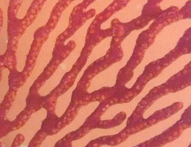02 RSF Polyps.jpg