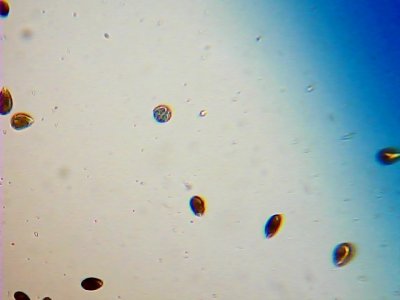 Esporangio y ostreopsis.jpg