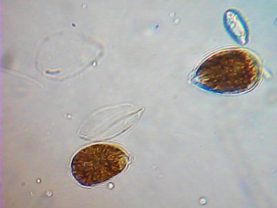 Theca desprendida 6 dÃ­a.jpg