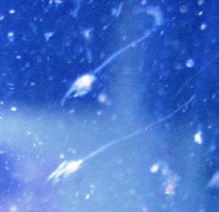 Neopetrolisthes maculatus - female 1. larva.jpg