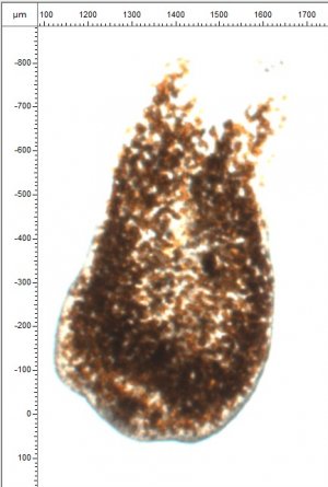 unknown bug microscope.jpg