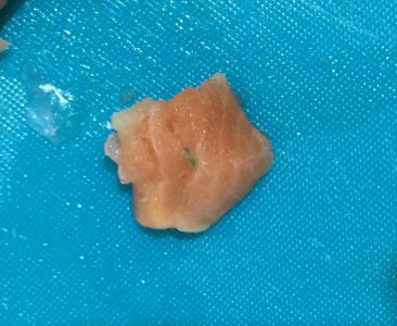 Zooxanthellae transplant 2.jpg