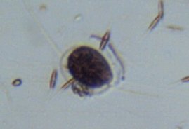 diatoms.jpg