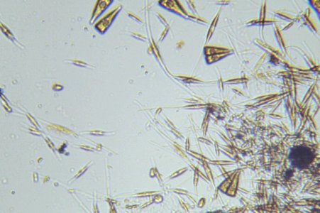 Photo on 4-8-16 at 7.02 PM #2.jpg