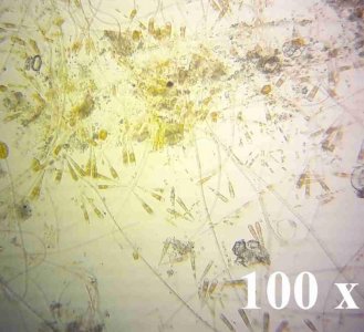 Unknown Bacteria BACK WALL 5.jpg