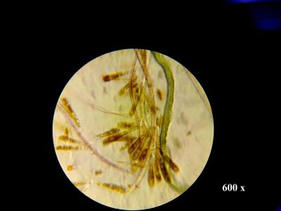 Unknown Bacteria BACK WALL 3.jpg