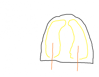 Untitled.png