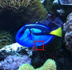 Tang urchin sting.JPG