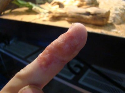 Finger.jpg