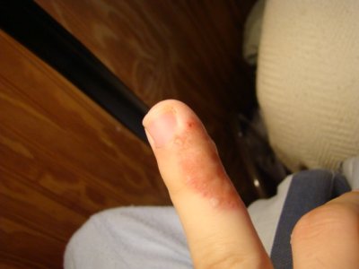 finger1.jpg