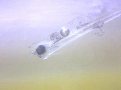 stomach bubble 1 Sept 2012.jpg