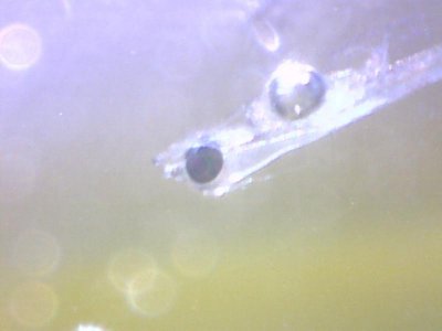 stomach bubble 2 Sept 2012.jpg